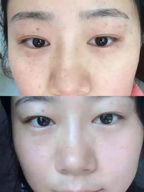 国产十大美白精华液,淡斑效果好的护肤品排名-第4张图片-广西高校网