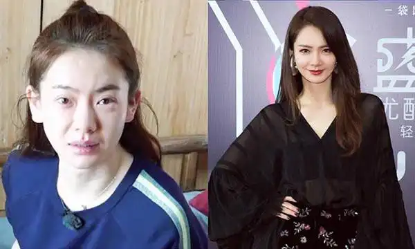 戚薇没化妆的对比