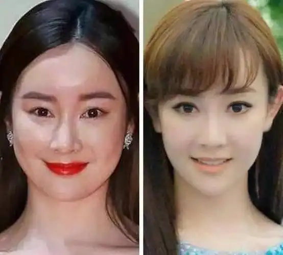 杨幂抿嘴习惯恐难改善,被指医美后遗症,演员真的别轻易动脸!