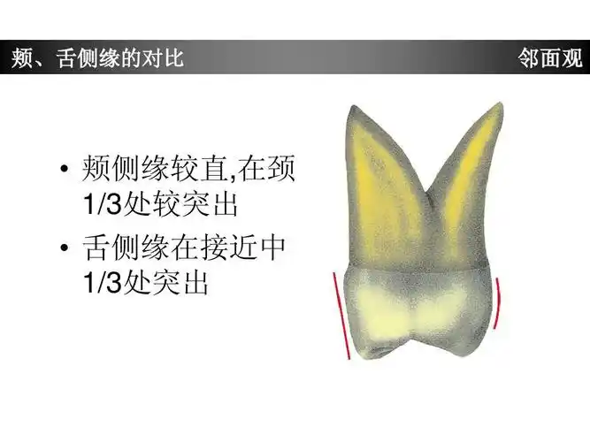 上颌第一磨牙牙体形态简述ppt