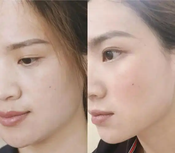 一条老10岁的"三条杠",用它360°滚动淡纹美白,你也能拥有光感"天鹅颈