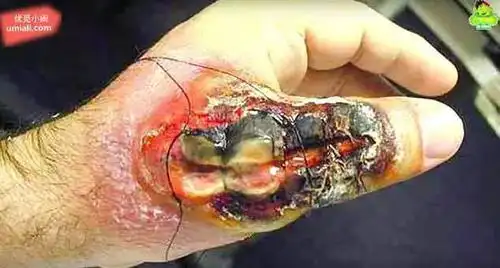 17张照片证明蜘蛛才是最恐怖的生物,慎入!(内含世界上最毒的5种)