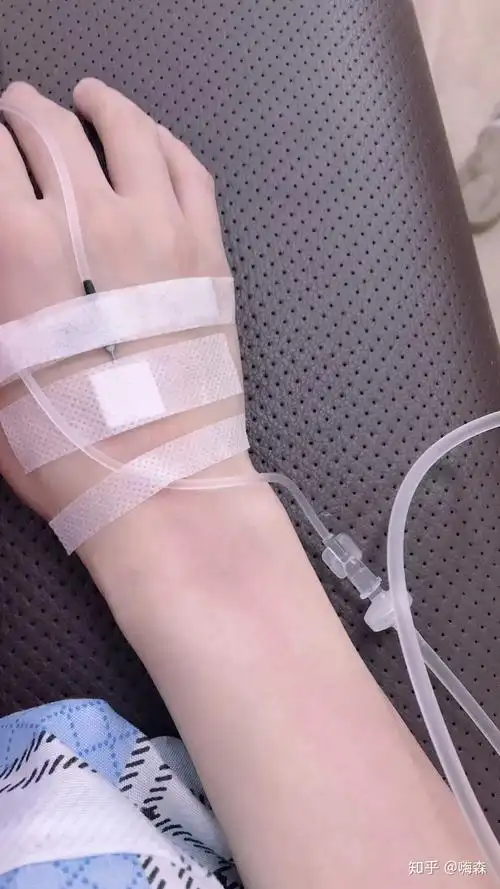 有没有输液的照片我给老师请的病假她要我发照片给她