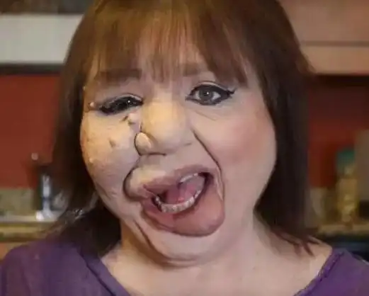 世界上最恶心的人图片看一眼吃不下饭又丑又恶心