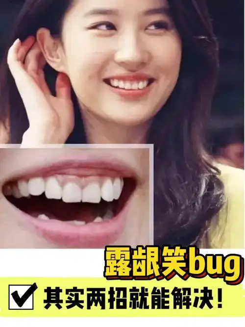 刘亦菲招牌露龈笑bug,其实两招就能解决