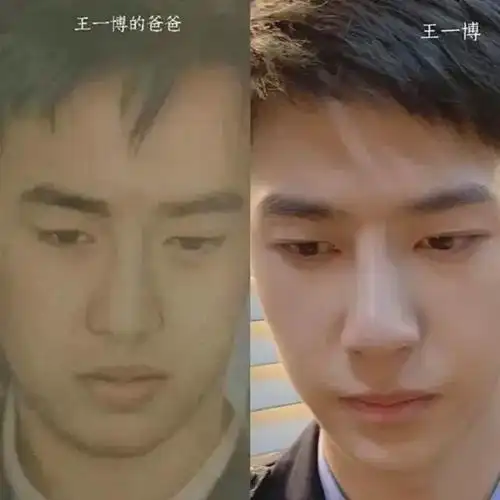 一部《追风者》,王一博被抓住了小把柄,这下整容实锤了?
