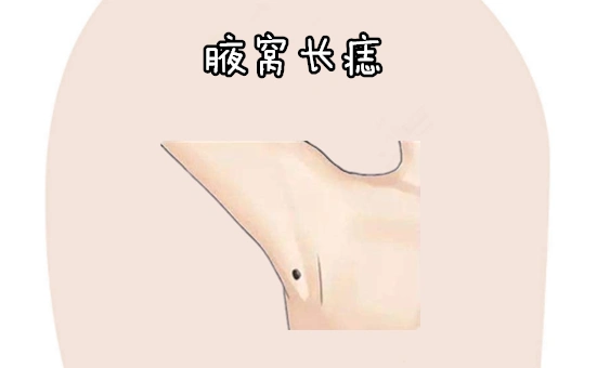 "千金难买4颗痣",个个生金,一个不愁钱,一个不愁权,皇帝命!_腾讯新闻