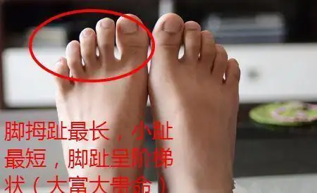 脚趾头上有这几个特征都是享福命