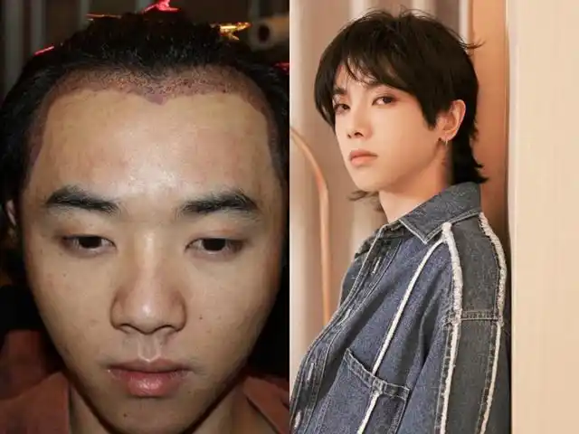 前女友晒照称华晨宇整容,斥张碧晨介入感情,歌迷会称只关注作品