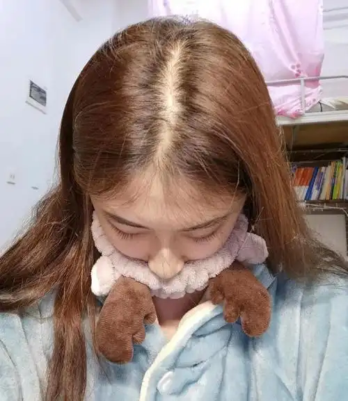 为什么25岁女生,头发越来越少?这几个臭美坏习惯,尽早改掉