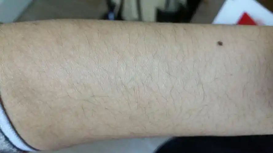 这种手毛是不是有点厉害,男生,可是我同学都没有一根的.