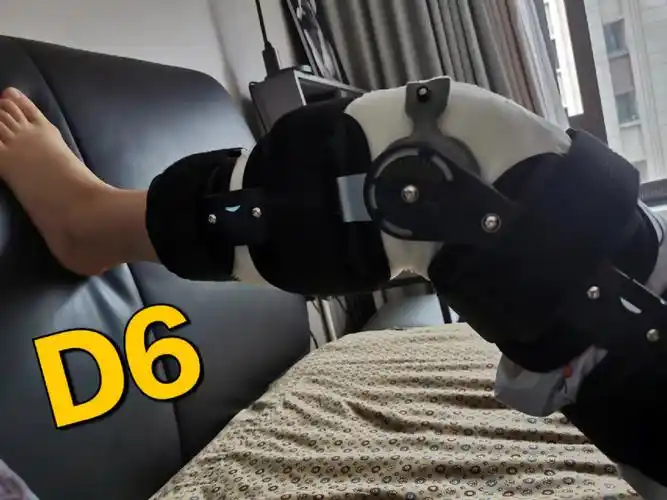 胫骨平台骨折塌陷术后d8天弯腿90