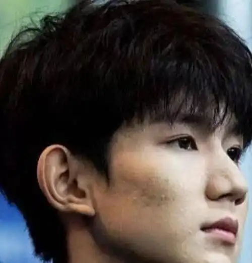 王源好惨他的脸怎么了