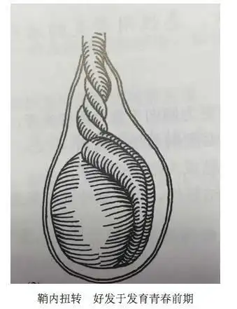 江西11岁男孩"蛋蛋"发黑,被迫切除!孩子有这些症状,赶紧去医院!