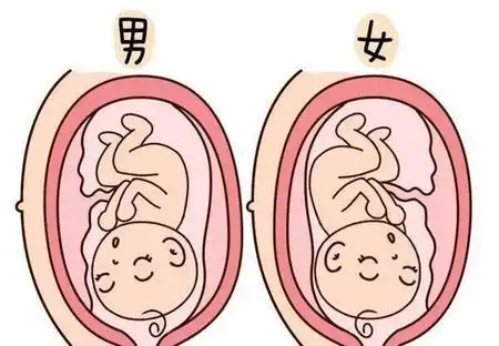 四维彩超单怎么看出来是男孩还是女孩(四维彩超怎么分