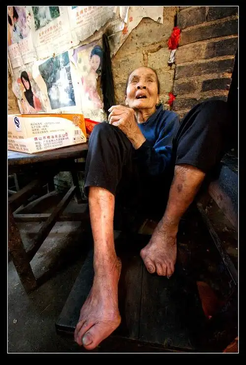 谁帮我找找老人脚的照片图片啊