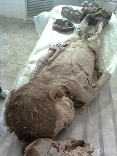 大体标本 - 临床病理讨论版 - 爱爱医医学论坛