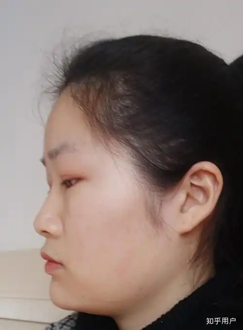 女生侧脸不好看怎么办