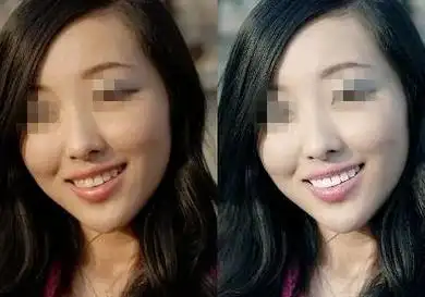 自从打了美白针,我再也不用为夏天防晒而苦恼了!