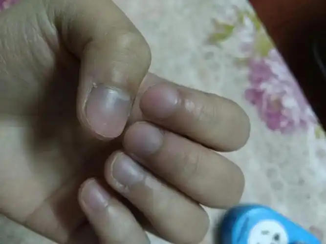 手脚冰凉指甲发紫发黑 然后心脏有时候会突然刺痛 然后上学爬上山走两