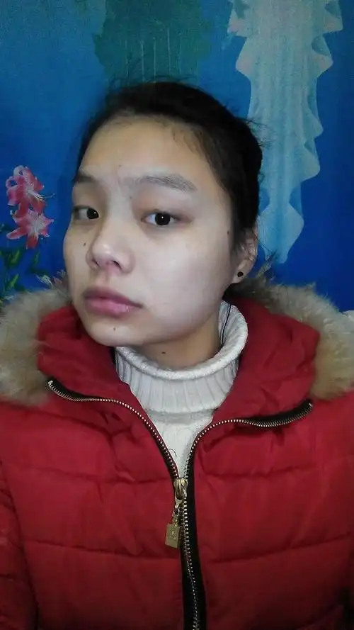 鼻翼大是不是不好看?