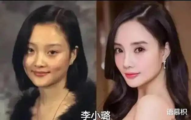 娱乐圈就是整容场开挂式逆袭明星出道前后对比你认出了几个