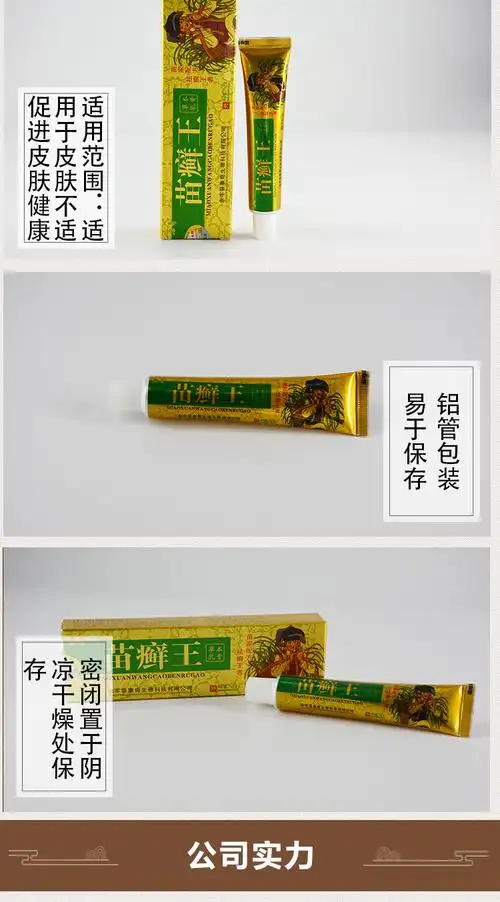 正品名奇苗癣王草本乳膏苗癣王软膏皮肤外用四季百草膏一件代发