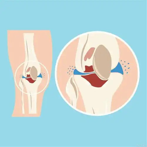 骨科主任秋冬养骨1种食物使劲吃膝盖不痛好过冬