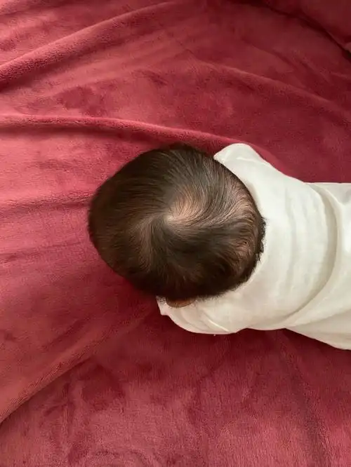 这种头型怎么睡圆呢 好像有一点右扁#睡头型  #宝宝头型  #婴儿头型