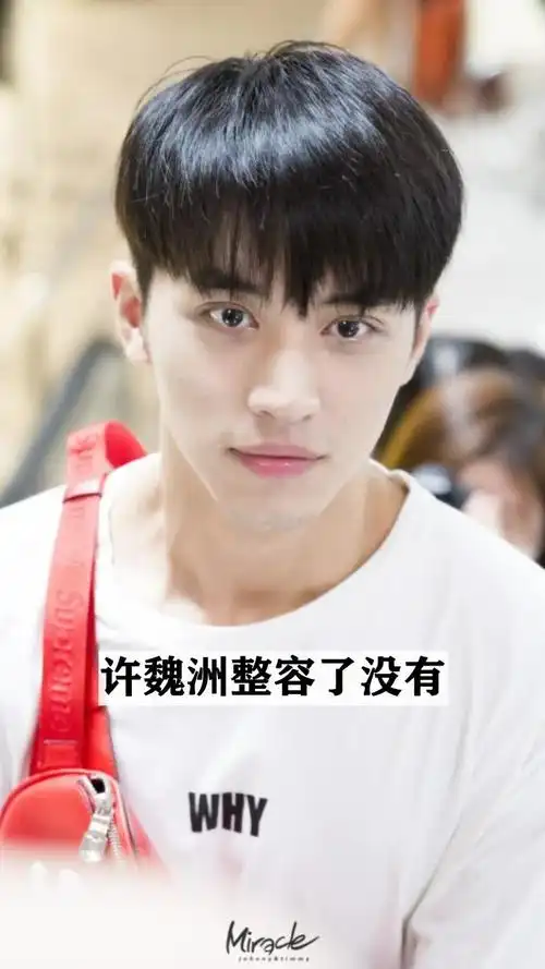 许魏洲整容了没有