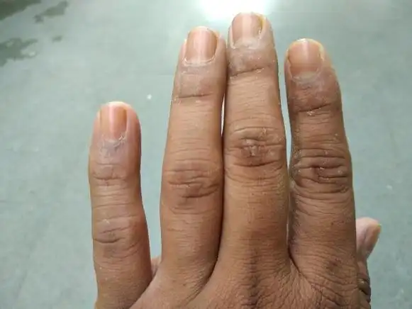 人类的手指,男,女图片下载