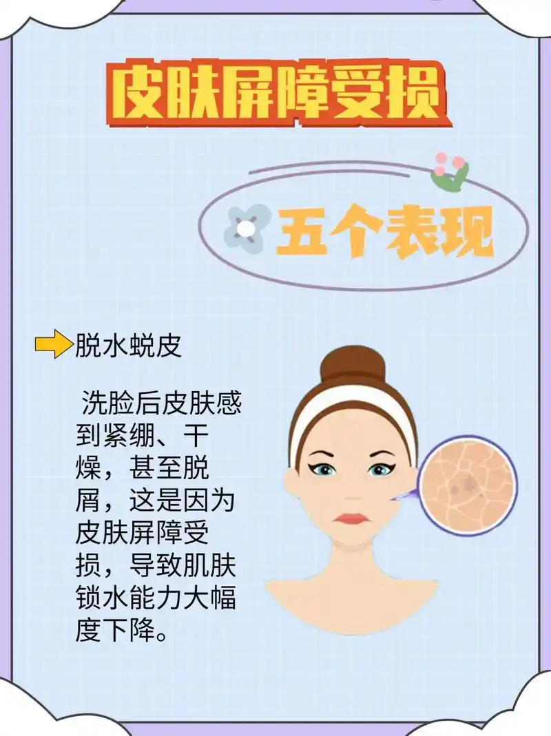 皮肤屏障受损的五个表现