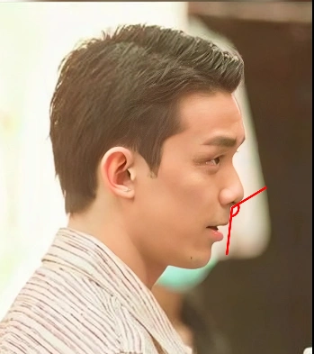 凸嘴猴化芒果脸这5位男星下颌面缺陷多却有挡不住的帅气