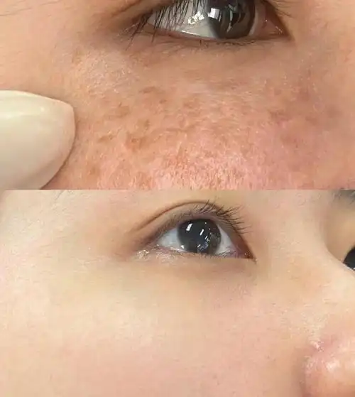 无论你"色斑"有多深,用老国货片仔癀,70岁以内都有救|美白|淡斑|祛斑