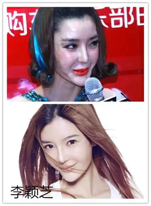 巩新亮再变残!盘点娱乐圈越整越丑的女明星