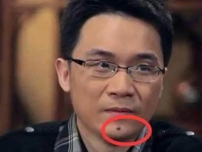 1,左下巴有痣的男人一般都很有学问,一肚子墨水,也是个非常注重物质