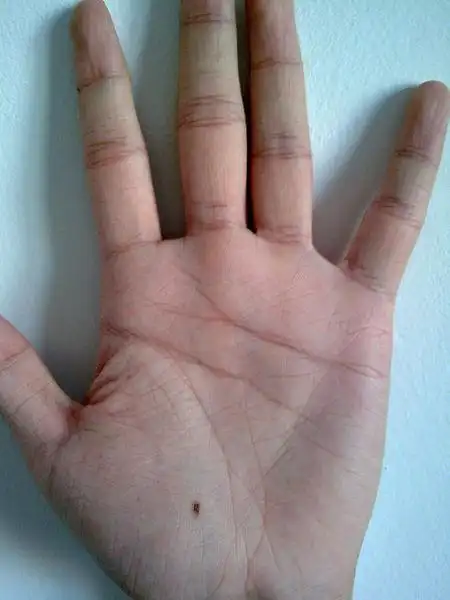 你的掌中,首先是金星丘有痣在加上感情线生. 来自佛心大师 - 微博