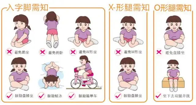 如果发现自家孩子有x型腿或o型腿,走路外八或内八字,要不要矫正呢?