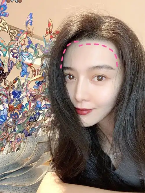 颜值干货|什么样的发际线才算好看71发际线存在的作用_圈子-新氧