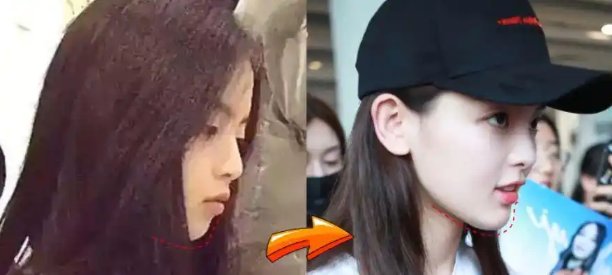 杨超越的未出道前照片对比,网友:看她下巴就知道为什么了!