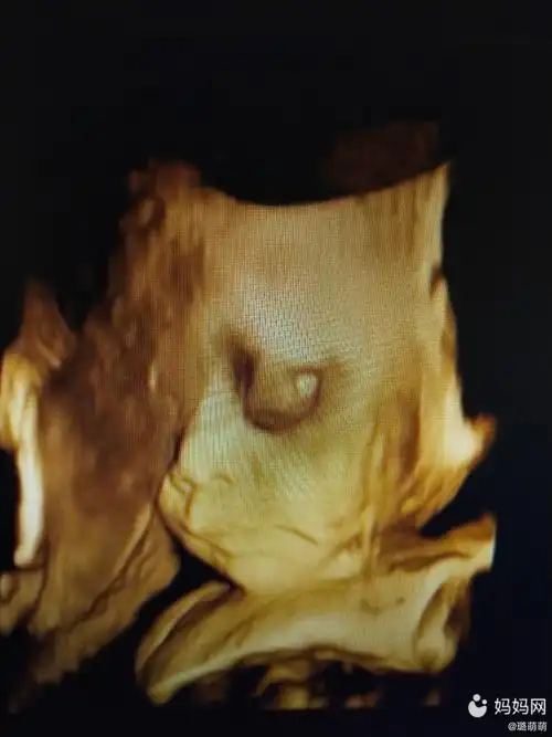 二次四维顺利通过,就是宝贝每次不配合不给看脸,每次都是侧脸.