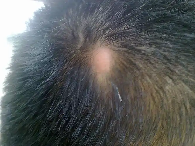 头皮上长个包,没头发了!