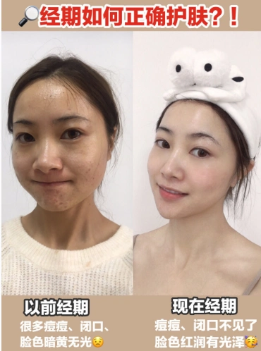 姨妈血颜色可以自查身体好坏!我知道的那些经期护理方法和护肤小妙招!