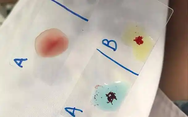 a型,b型,ab型,o型,哪种血型的人抵抗力更好?医生说出答案