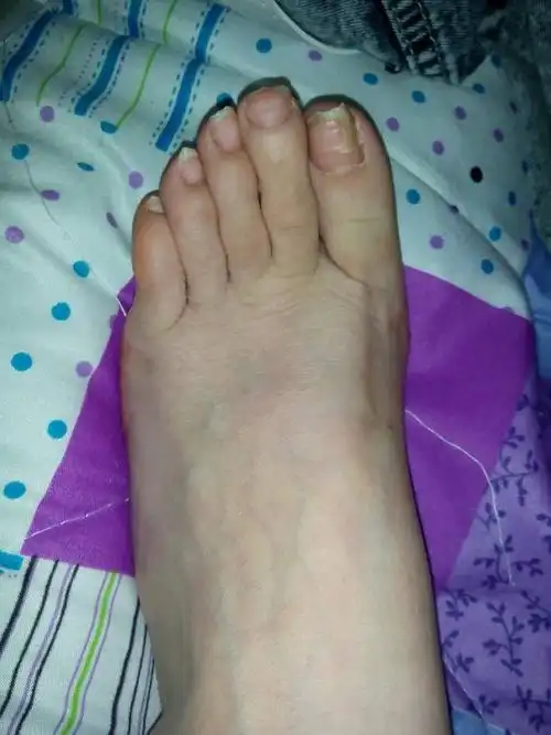 为什么我的脚长这样 ?