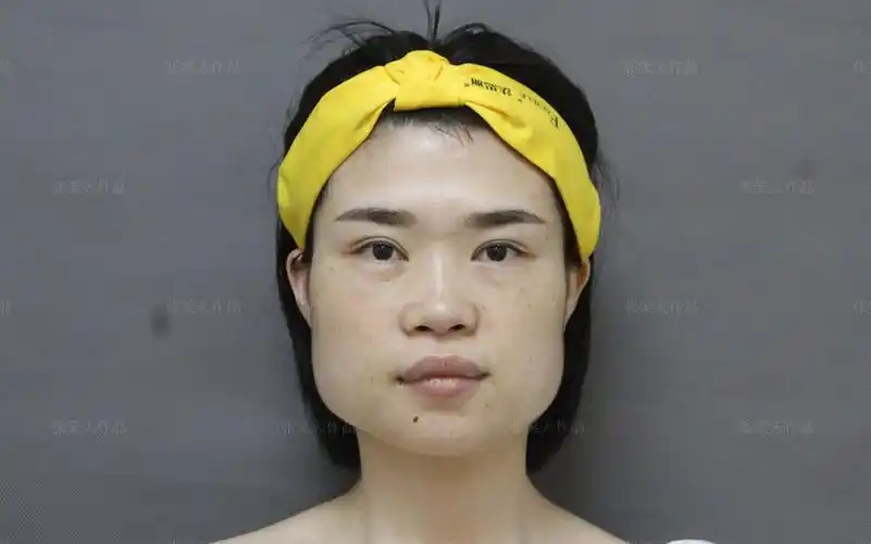 方脸系列|脸宽咬肌大,体重不过百,但总被说胖姑娘直呼太难了!