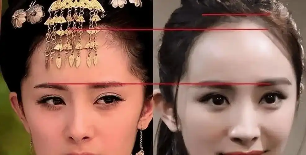 她需要用整容的手段来维持自己的容貌,那为什么舍不得花这个植发钱呢?