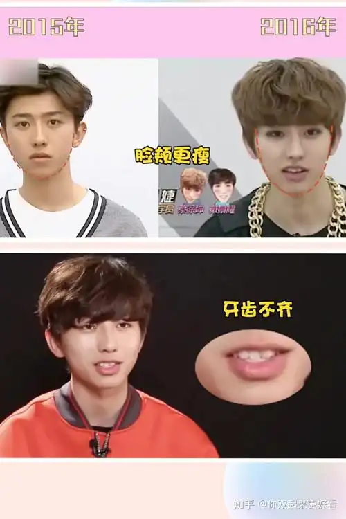 蔡徐坤为什么总是被说整容? - 知乎