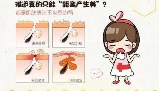 怎样清洁毛孔里的垃圾,清洁毛孔最有效的方法