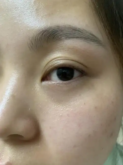 有没有和我一样多层眼皮的姐妹